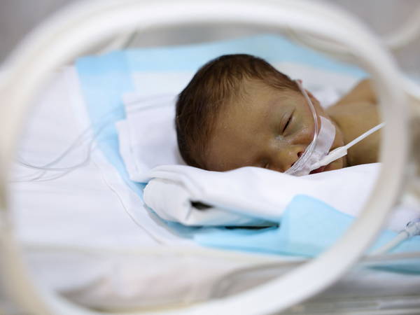 Premature births in the U.S. remain at an all-time high, the March of Dimes reports